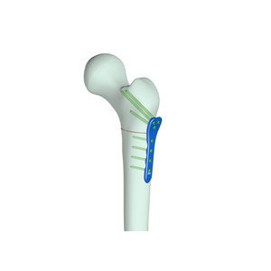 modello anatomico di rotula