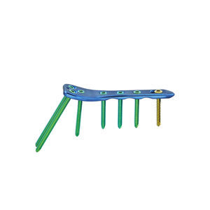 placca per osteotomia per femore