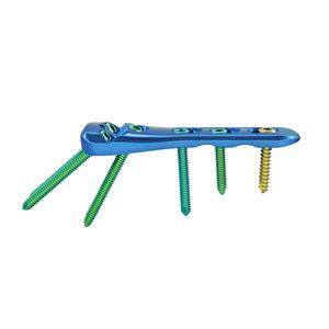 placca per osteotomia per femore 1