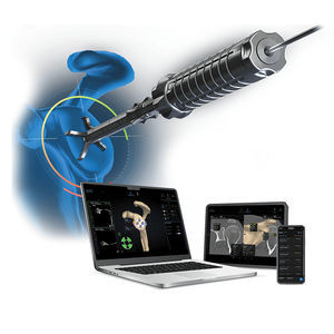 software di pianificazione preoperatoria 1