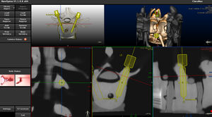 software per chirurgia robotica