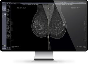 PACS per diagnostica per immagini 1