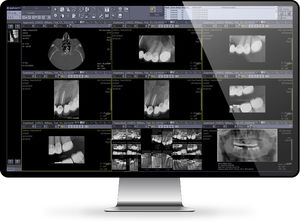 PACS per diagnostica per immagini 1