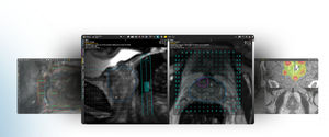 software per tomografia computerizzata