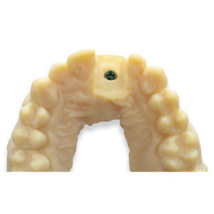materiale odontoiatrico in termoplastica 1