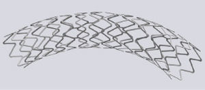 stent coronarico 1