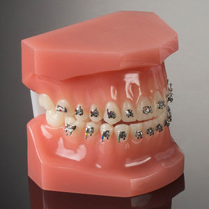 bracket ortodontici in metallo