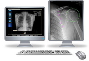 PACS per diagnostica per immagini