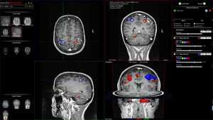 software di controllo qualità / di analisi / per reportistica / per MRI funzionale