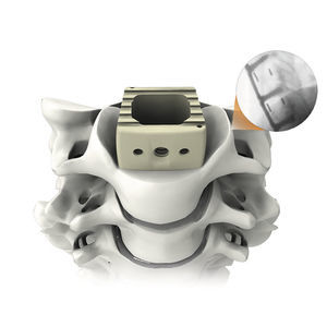 gabbia intersomatica cervicale 1