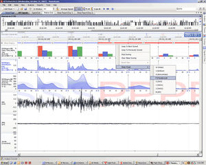 software per stimolazione neurofisiologica