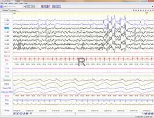 software per polisonnografia