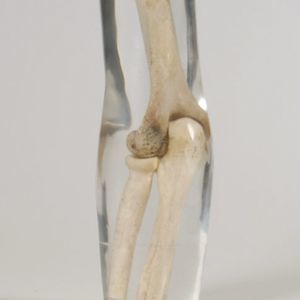 phantom di calibrazione per radiografia 1
