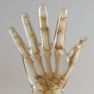 phantom di calibrazione per radiografia 1