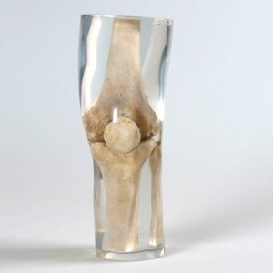 phantom di calibrazione per radiografia 1