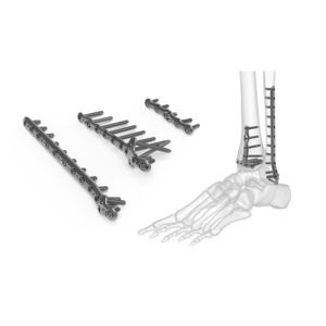 placca di compressione per tibia