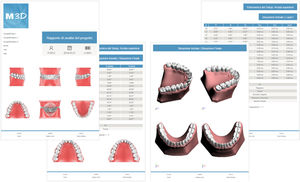 software ortodontico