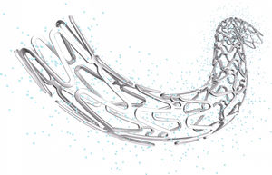stent coronarico