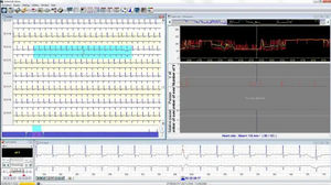 software di analisi 1