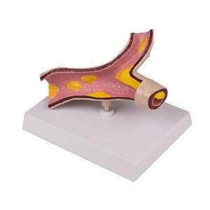 modello anatomico di arteria