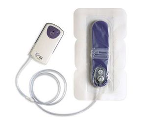 unità terapeutica a pressione negativa a batteria 1