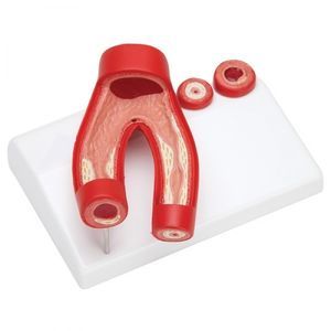 modello anatomico di arteria