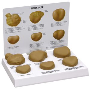 modello anatomico di prostata 1