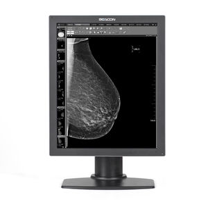 monitor per diagnostica per immagini