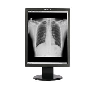 monitor diagnostico