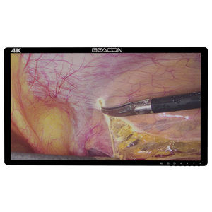 monitor chirurgico