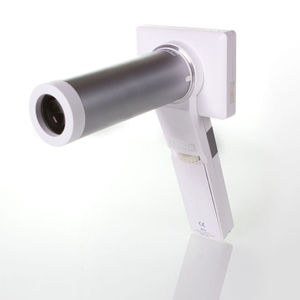 telecamera retinica non-midriatica 1