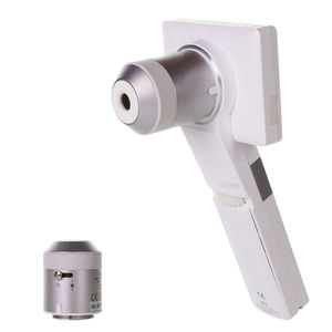 videodermatoscopio 1