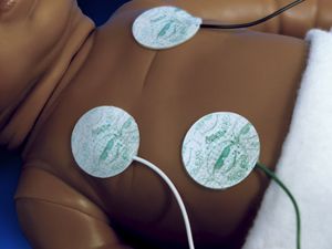 elettrodo ECG monouso