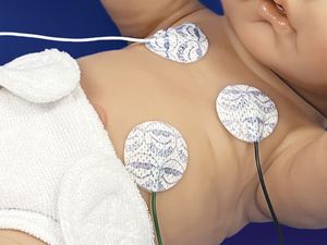 elettrodo ECG pediatrico