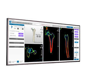 software per tomografia computerizzata