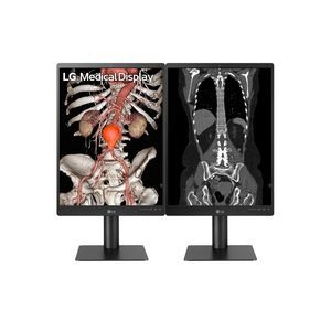 monitor diagnostico