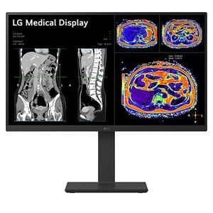 monitor medico