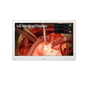 monitor per endoscopia