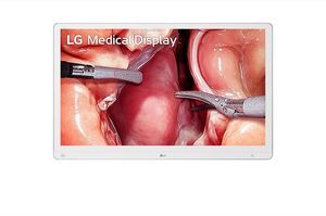 monitor per endoscopia