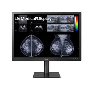 monitor diagnostico