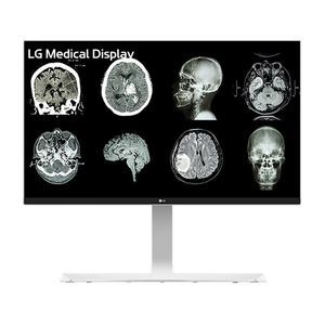 monitor medico