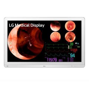 monitor per endoscopia