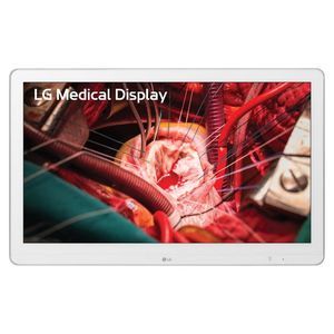 monitor diagnostico