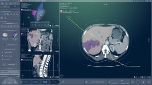 modulo software di analisi