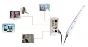 fotocamera intraorale 1