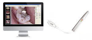 fotocamera intraorale 1