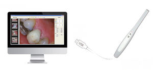 fotocamera intraorale