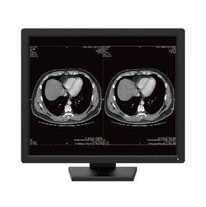 monitor diagnostico