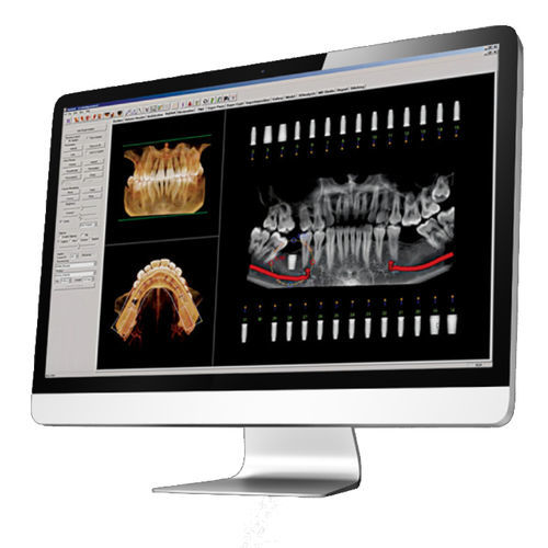 Software di controllo - Invivo™ 6  - DEXIS - di visualizzazione / diagnostico / di pianificazione del trattamento