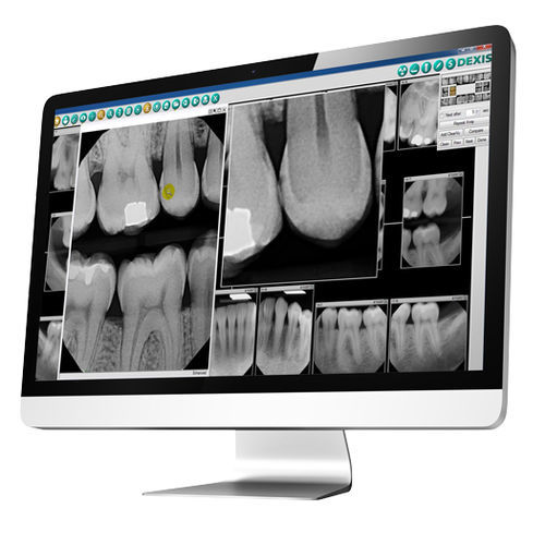 Software odontoiatrico - DEXIS - di acquisizione / di pianificazione del trattamento / d’importazione